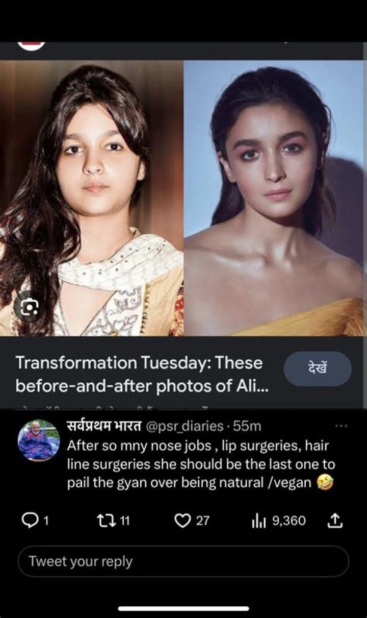 Devon Jenelle Plastic Surgery Speculations and Rumours