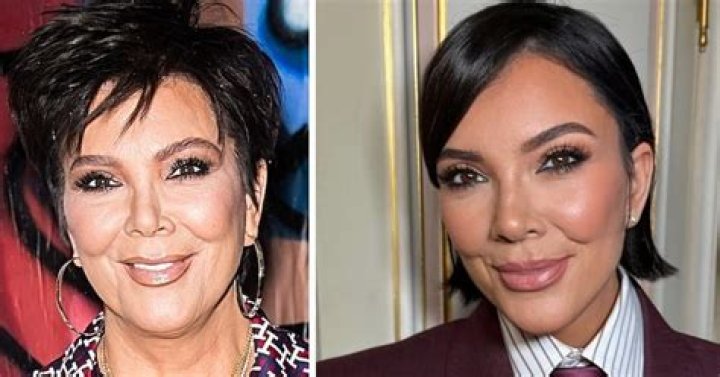 First Images Of Kimberly Loaiza After Her New Cosmetic Surgery